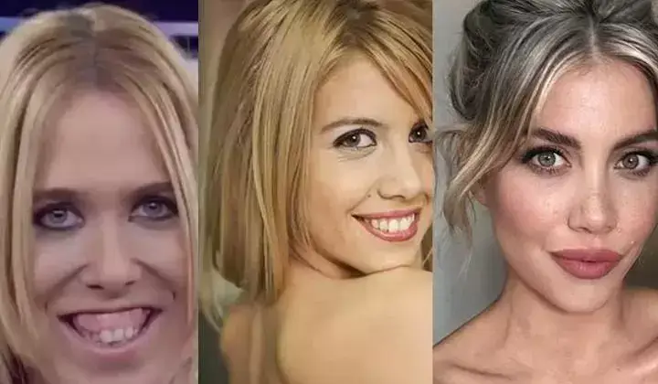 Wanda Nara’nın estetiksiz halleri ağızları açık bıraktı
