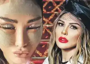 Selen Görgüzel’in son estetik operasyonu pahalıya patladı