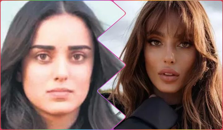 Bestemsu Özdemir'in 'estetik yaptırmadım' iddiası sosyal medyanın diline düştü 2 Bestemsu Özdemir’in ‘estetik yaptırmadım’ iddiası sosyal medyanın diline düştü