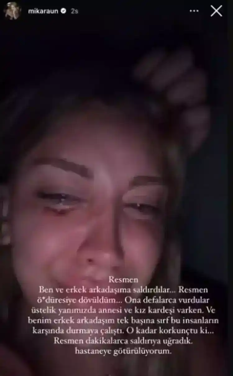 Mika Can Raun sevgilisiyle birlikte saldırıya uğradı 5 6672dced8217eb890d3eb17a Mika Can Raun sevgilisiyle birlikte saldırıya uğradı