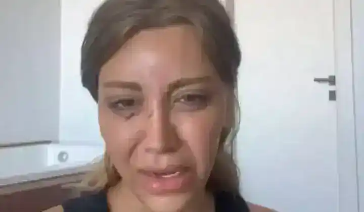 Mika Can Raun sevgilisiyle birlikte saldırıya uğradı 3 Mika Can Raun sevgilisiyle birlikte saldırıya uğradı