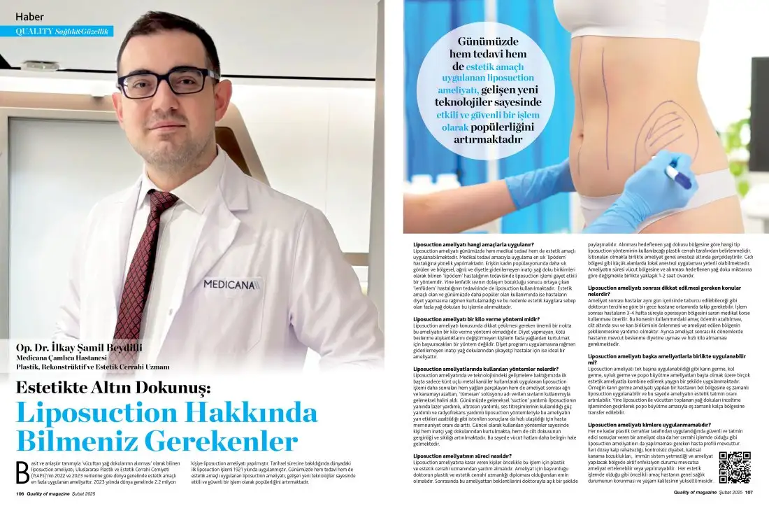 ilkay samil beydilli1 Estetikte Altın Dokunuş: Liposuction Hakkında Bilmeniz Gerekenler