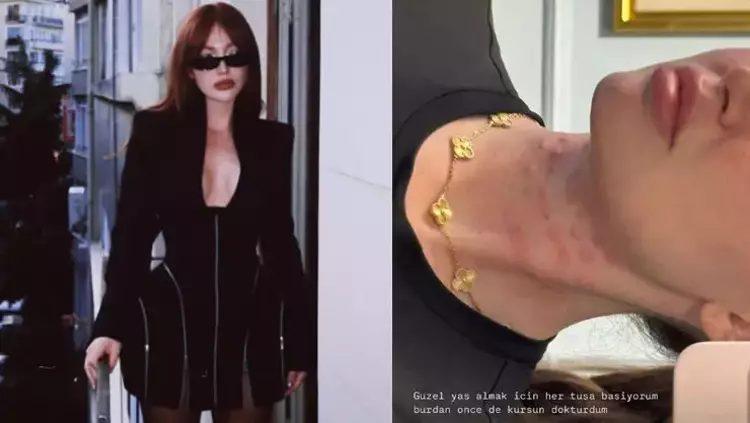 Danla Bilic yine doktor kapısında 3 68526b65f201ed8faee0fc90 Danla Bilic yine doktor kapısında