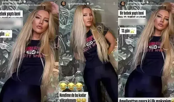 Gülşah Saraçoğlu estetik sonrası ortaya çıktı