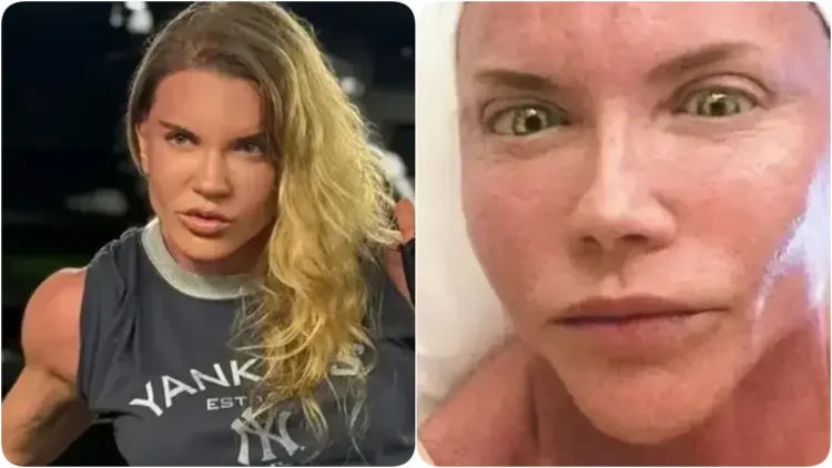 Biricik Suden bu kez estetiğiyle gündemde 12 Biricik Suden bu kez estetiğiyle gündemde