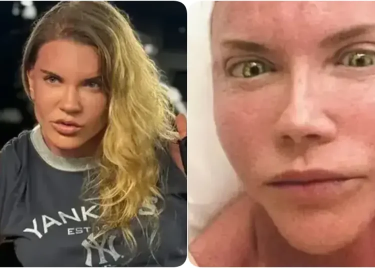 Biricik Suden bu kez estetiğiyle gündemde