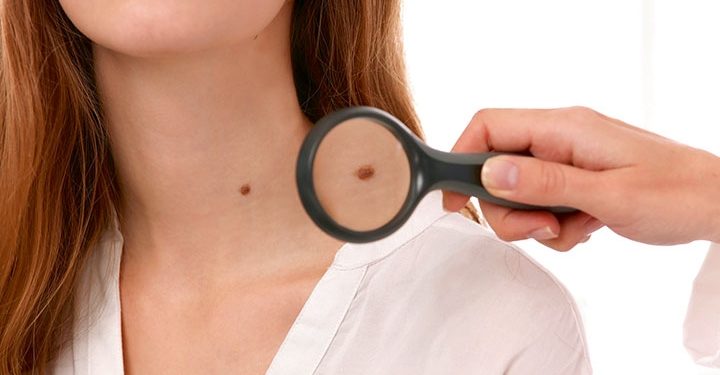 Rekonstrüktif ve Estetik Cerrahi Uzmanı Doç. Dr. Osman Kelahmetoğlu, ben takibinin önemini anlattı