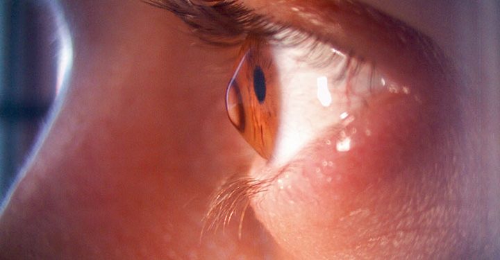 Doç. Dr. Efekan Coşkunseven, ‘Keratokonus’ hakkında merak edilenleri Quality’e anlattı