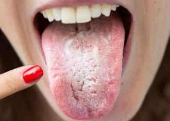 Dildeki renk değişimleri ne anlama geliyor?