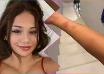 Seksi fenomen Merve Taşkın, eski sevgilisinden şiddet gördüğü zamanları anlattı