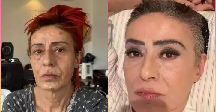 Yüzü yanan Yıldız Tilbe çareyi imaj değiştirmekte buldu