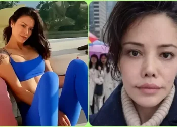 Yüz nakli yaptıran Didem Ceran son halini paylaştı